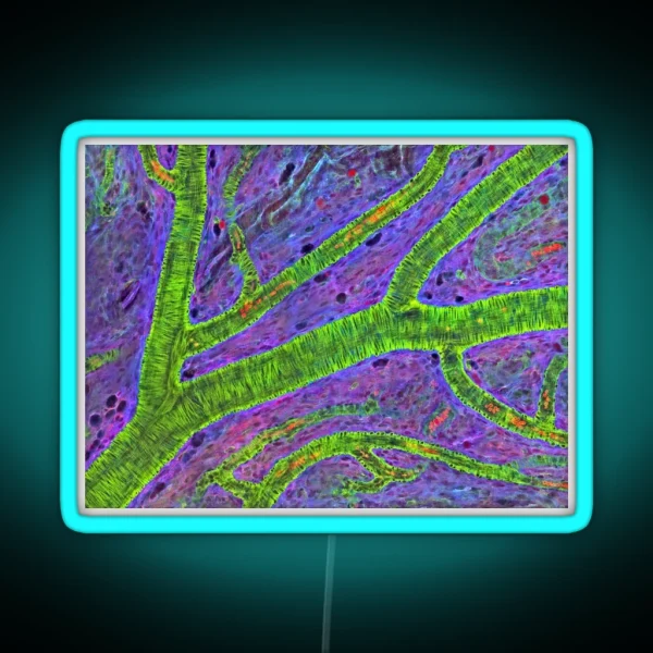 Retina Blood Vessel P424 0240 RGB Neon Sign