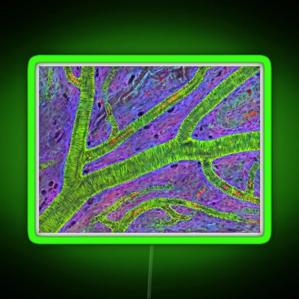 Retina Blood Vessel P424 0240 RGB Neon Sign