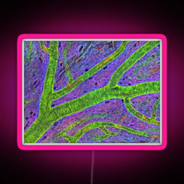Retina Blood Vessel P424 0240 RGB Neon Sign