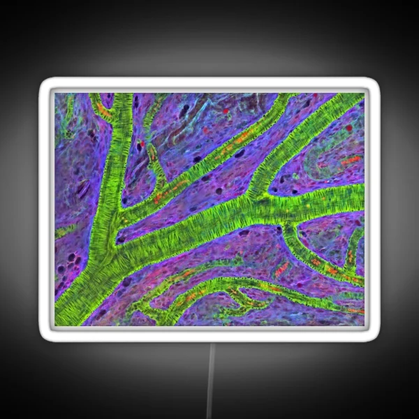 Retina Blood Vessel P424 0240 RGB Neon Sign