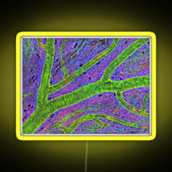 Retina Blood Vessel P424 0240 RGB Neon Sign